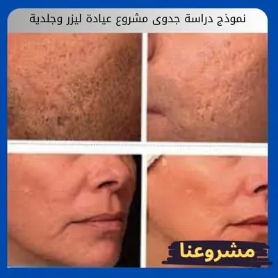 نموذج دراسة جدوى مشروع عيادة ليزر وجلدية نموذج دراسة جدوى مشروع عيادة ليزر وجلدية